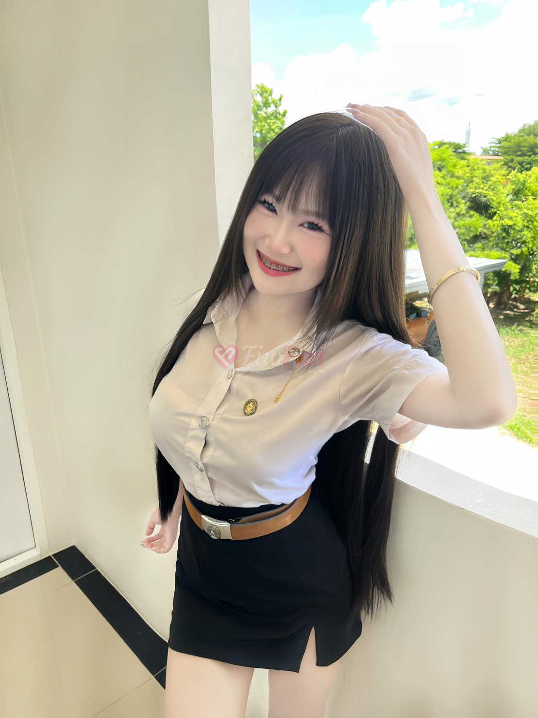 Story 1