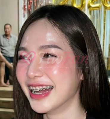 น้องแยม🌈มาใหม่📌 - ไซด์ไลน์ - 6a49c142f3924_IMG_2233 - fiwfans